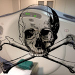 gekaapte CT-scanner